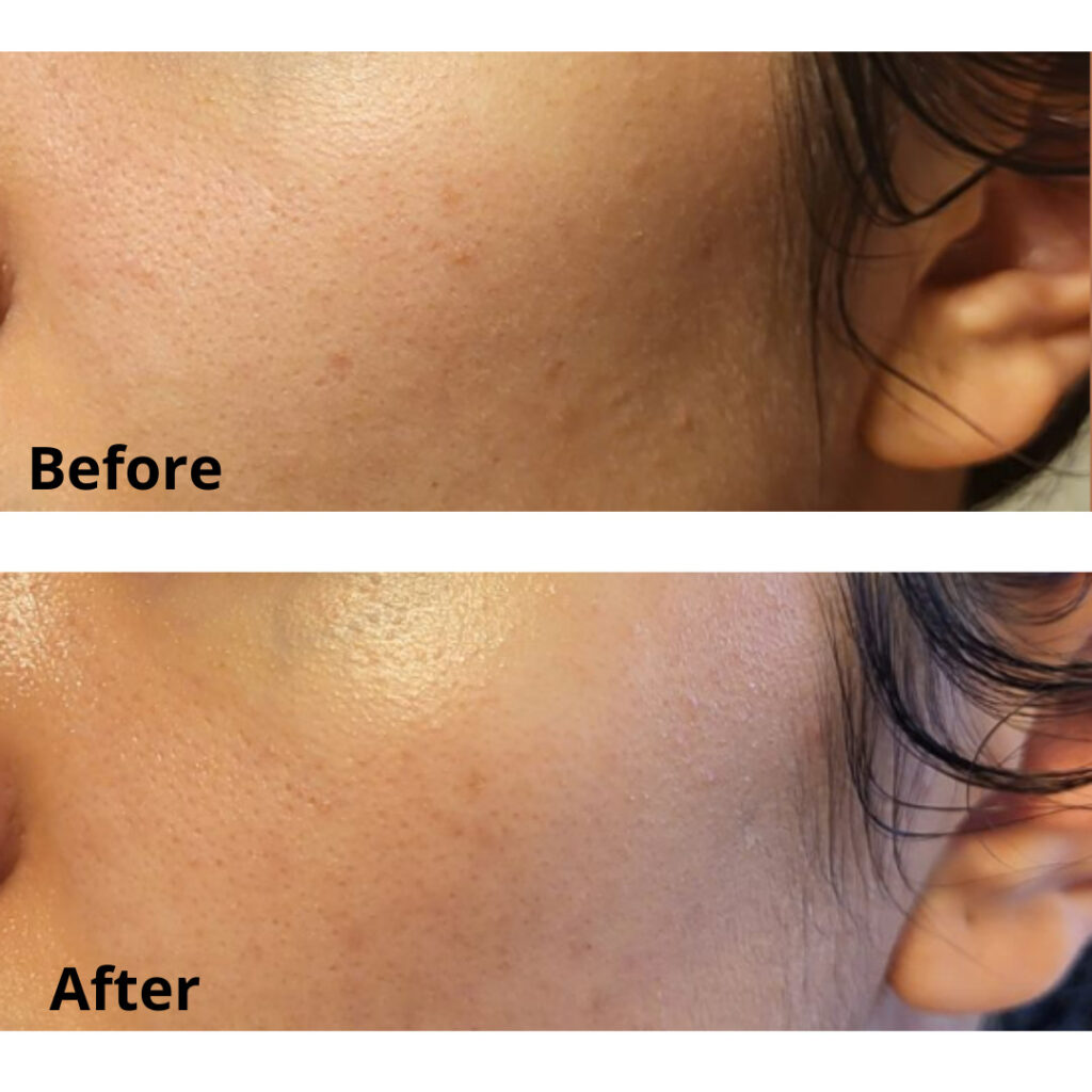 Đánh Giá Chi Tiết Serum Vitamin C